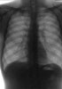 Перельман М.И. - Диагностика и химиотерапия туберкулеза органов дыхания - 2003 год