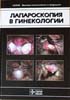 Савельева Г.М., Фёдоров И.В. - Лапароскопия в гинекологии - 1999 год